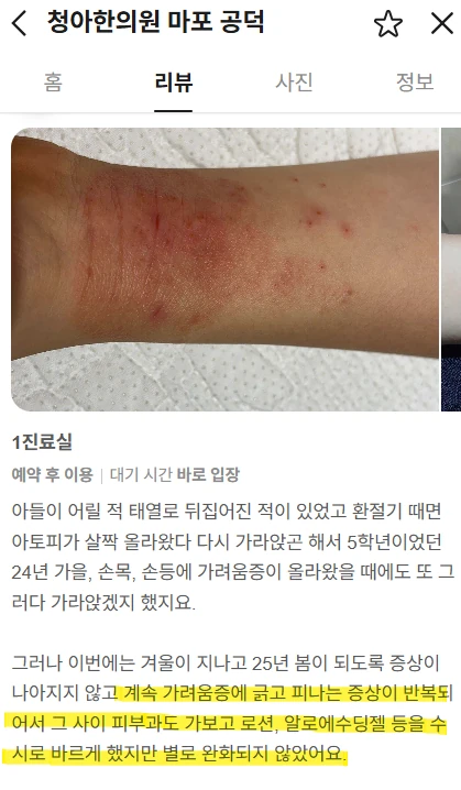 지속되는 가려움과 피부 증상으로 내원한 아토피 환자의 치료 후기