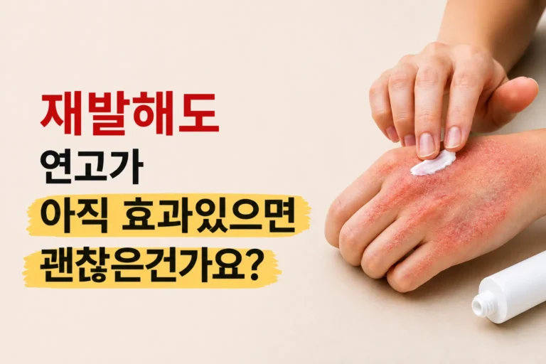 습진 아토피 스테로이드 연고로 버티고 계신가요? | 부작용이 없다고 안심해선 안 되는 이유