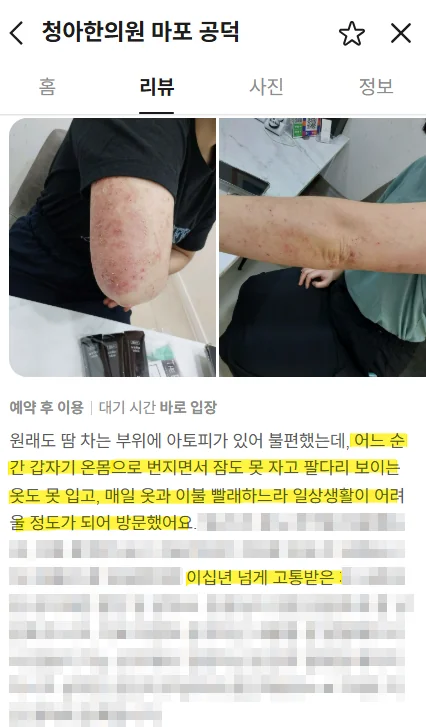 아토피 환자가 호소한 가려움과 수면 문제