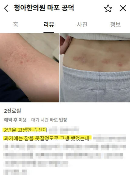 습진 환자가 호소한 가려움과 수면 문제